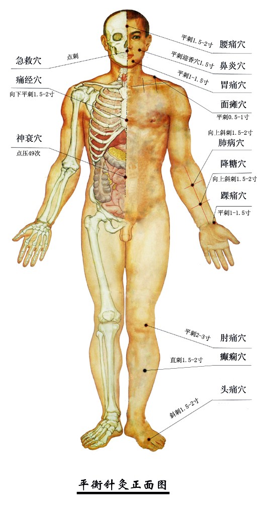 平衡针灸的神奇之处